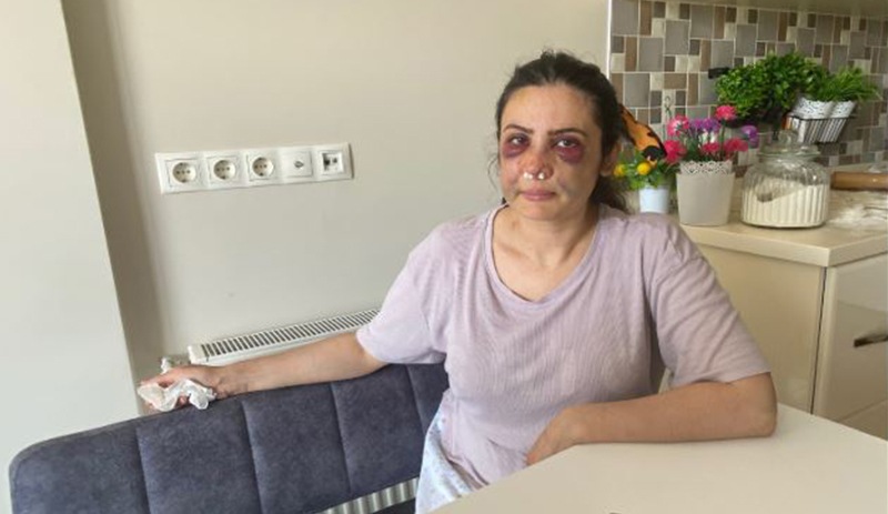 Derya Elbasan'a silahlı saldırıda bulunan eşi gözaltına alındı