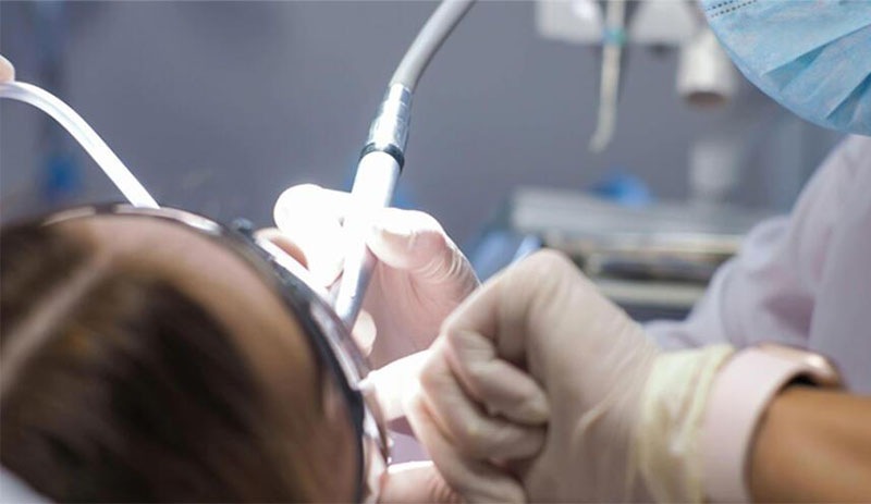 Döviz kurundaki artış diş tedavisinde kullanılan malzeme fiyatlarını üç kat artırdı